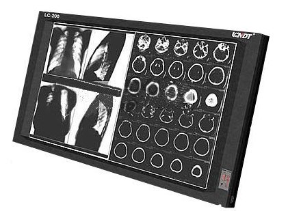 LC-200H-D – Filmbetraktere – NDT-utstyr